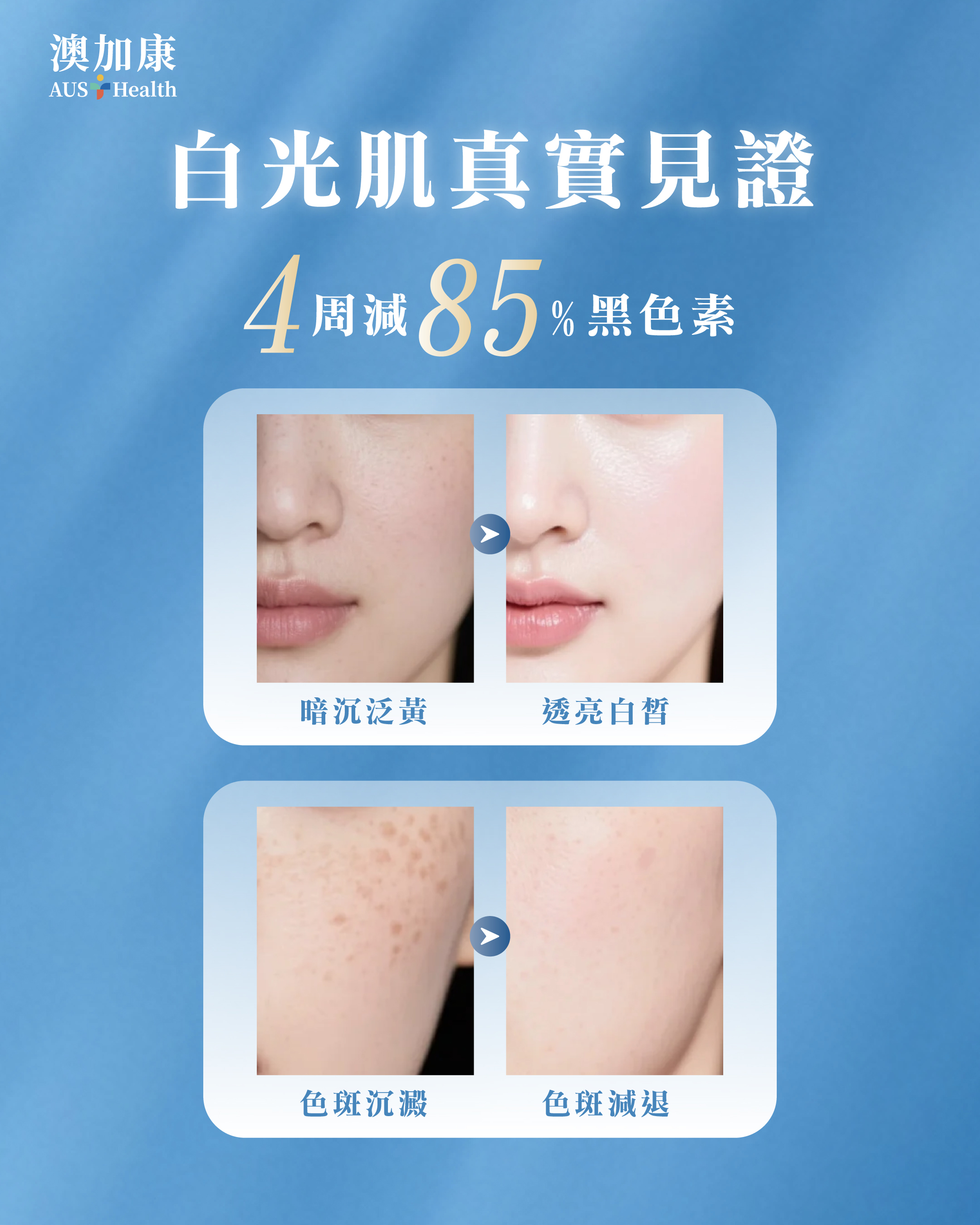 AUS Hcalth 澳加康 SPARK-C 白光丸30日