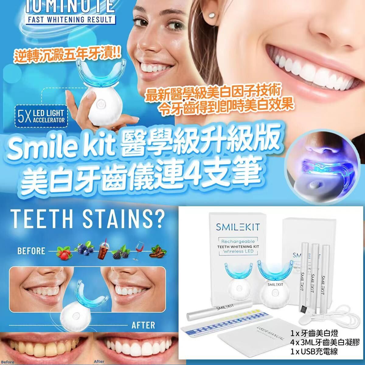 【UB8968】Smile Kit醫學級升級版美白牙齒儀連4支筆