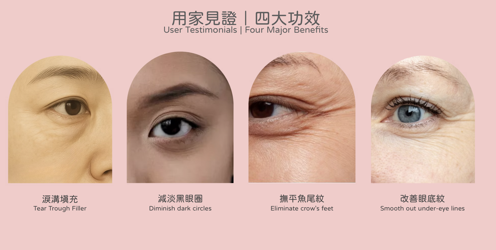 Juvelook I 眼部素顏針 香港 醫美診所