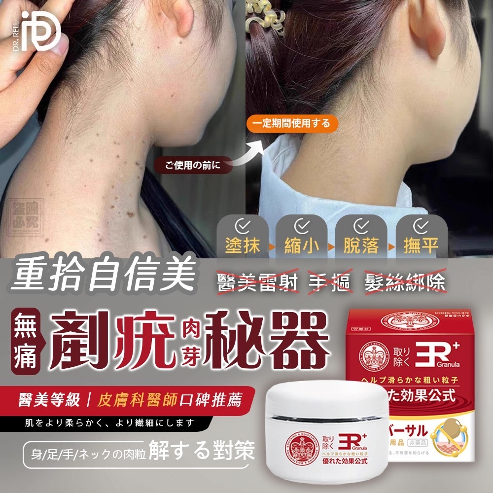 Dr.Rell醫美級祛肉芽急救膏
