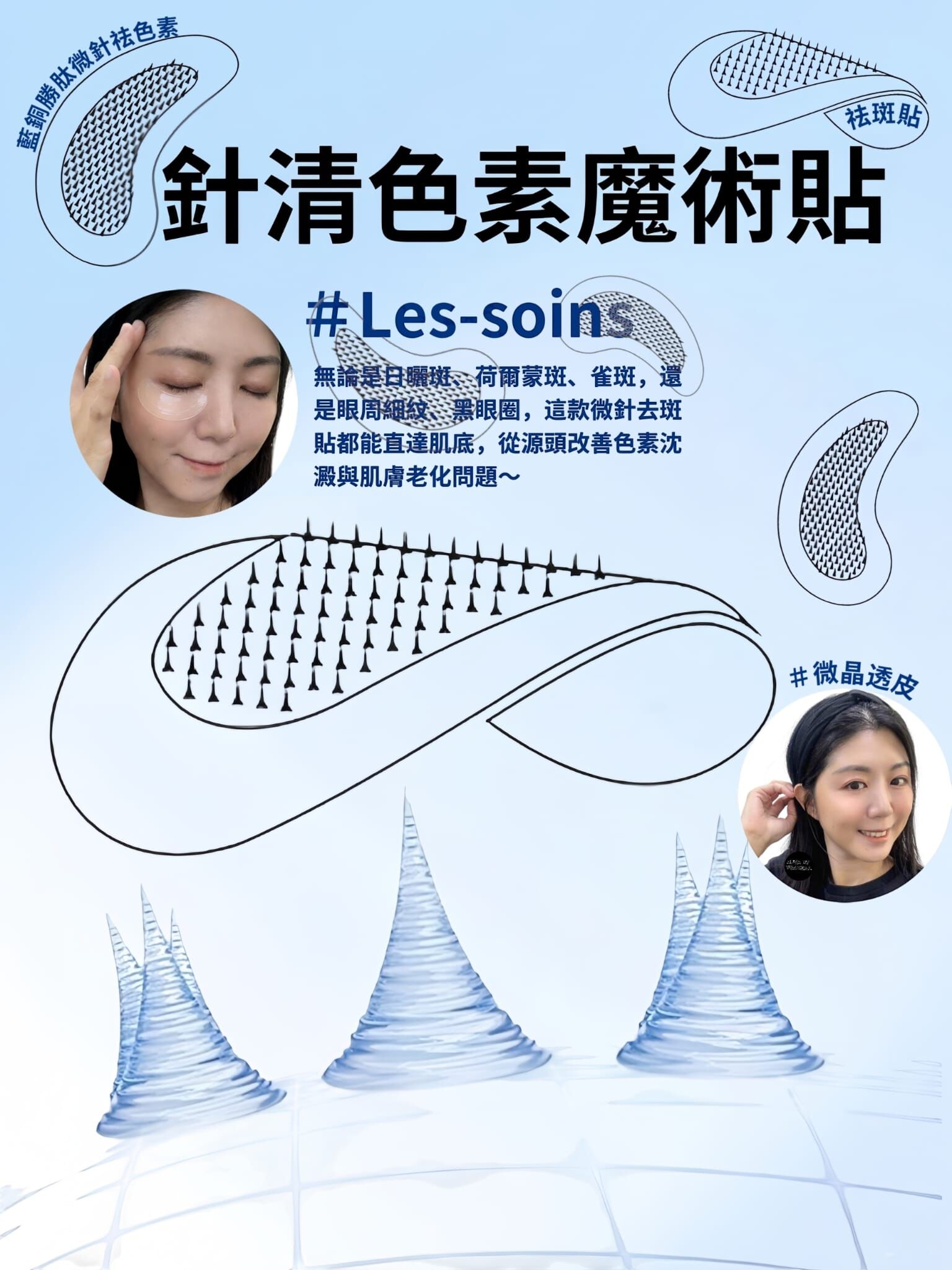 （針清色素魔術貼） ✨Les soins Mirconeedle藍銅勝肽微針祛色素+祛斑貼Z861 (一套10貼)