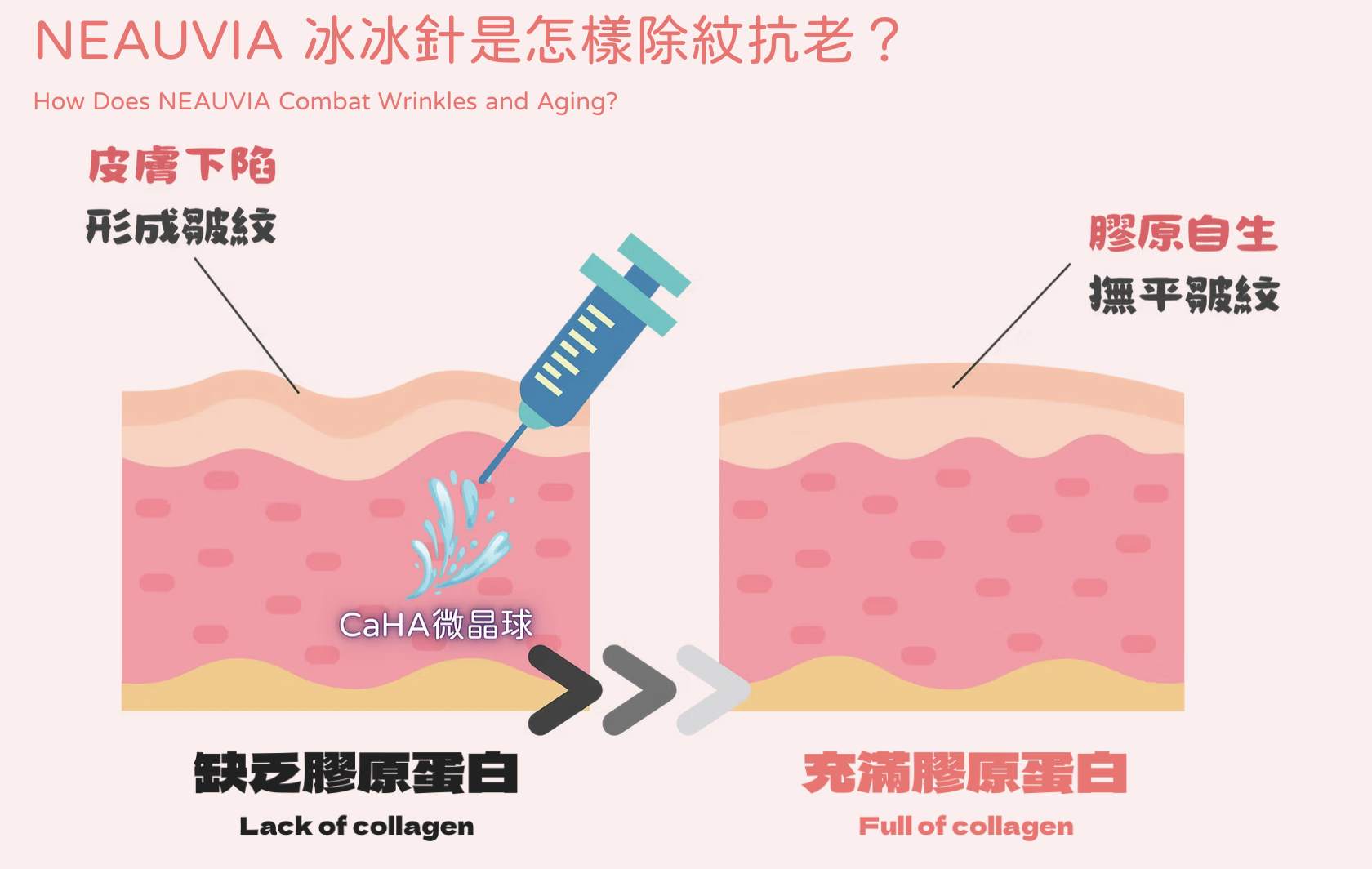 NEAUVIA ​冰冰針 水光針 醫美診所 ​冰冰针 水光针 医美诊所