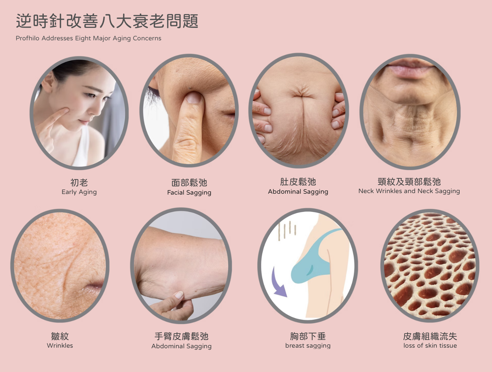 Profhilo 逆時針 水光針 醫美診所 逆时针 水光针 医美诊所