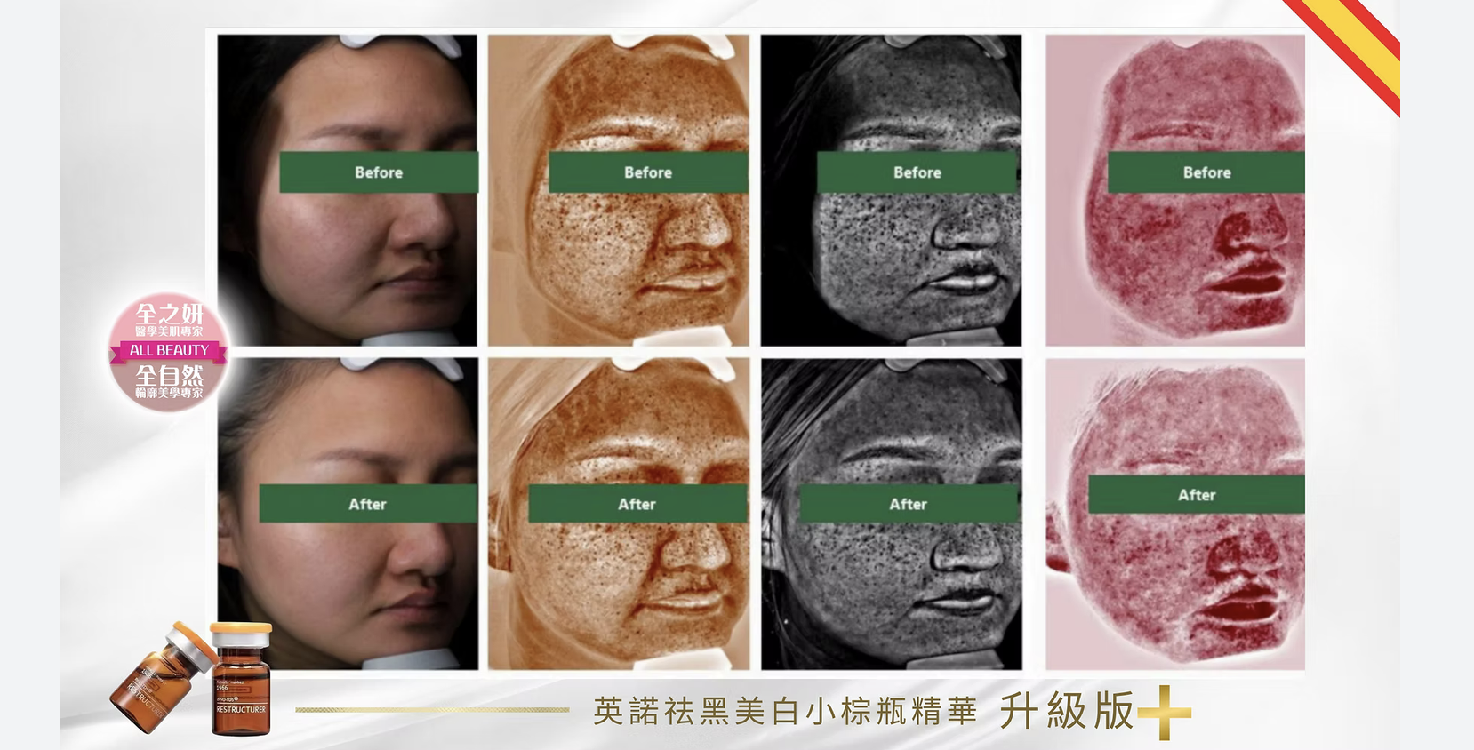 英諾祛黑小棕瓶升級版 美白 水光針 醫美診所 英诺祛黑小棕瓶升级版 美白 水光针 医美诊所