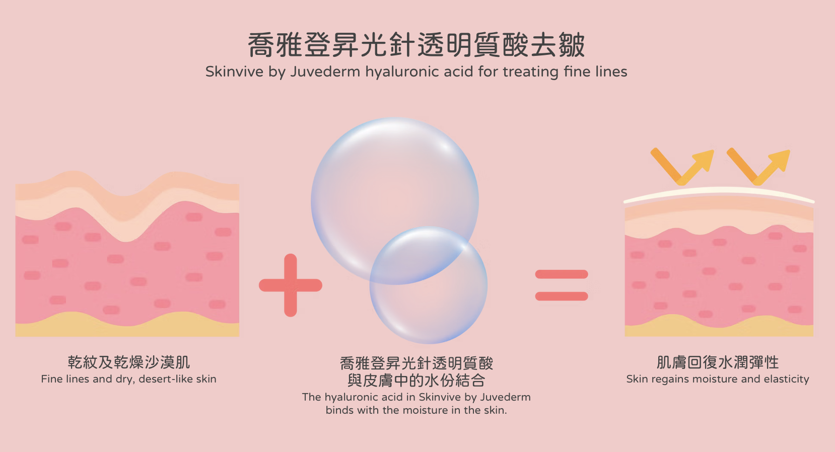 喬雅登昇光針 Skinvive by Juvederm 水光針 醫美診所 乔雅登升光针 Skinvive by Juvederm 水光针 医美诊所