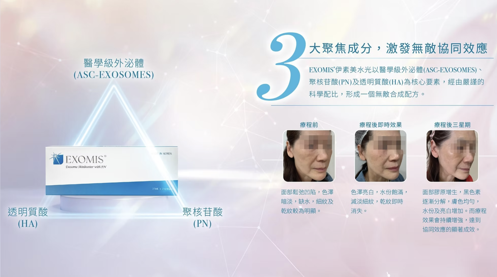 ​韓國EXOMIS伊素美醫學級幹細胞外泌體水光 醫美診所 医学级干细胞外泌体水光 医美诊所