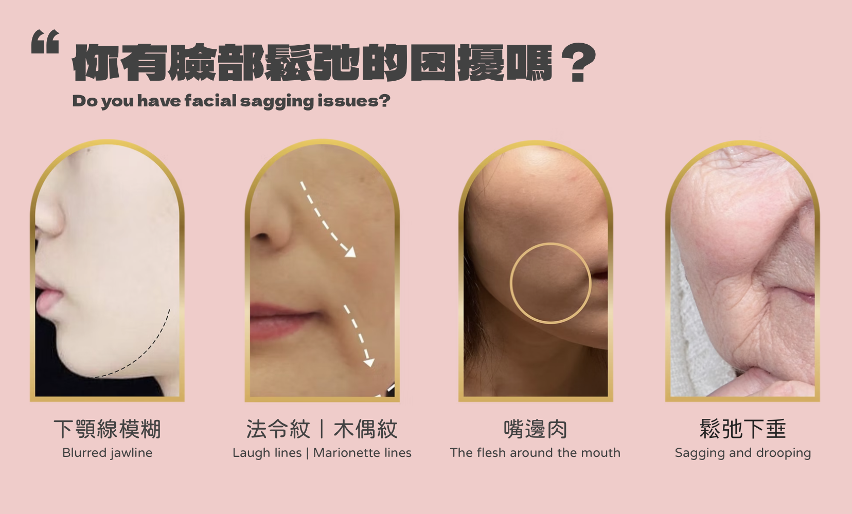 埋線提拉 醫美診所 埋线提拉 医美诊所