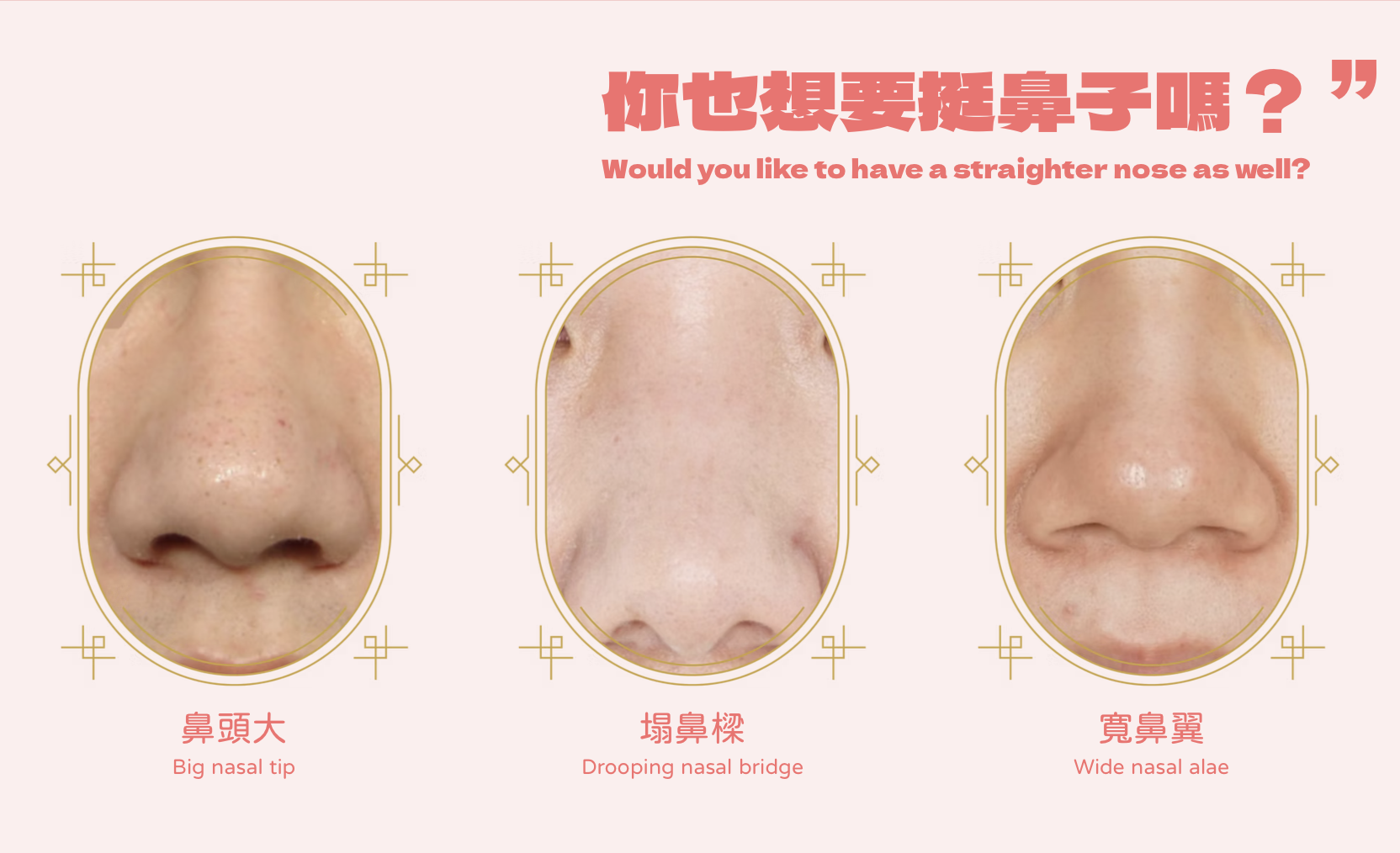 埋線提拉 醫美診所 埋线提拉 医美诊所