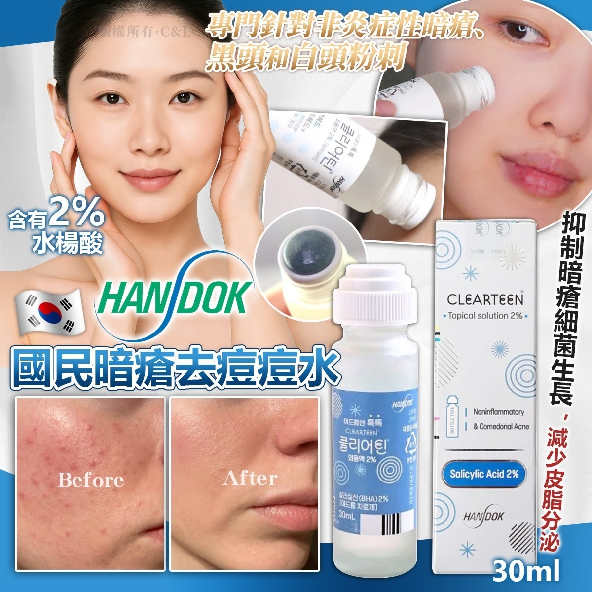 韓國Handok國民暗瘡去痘痘水30ml