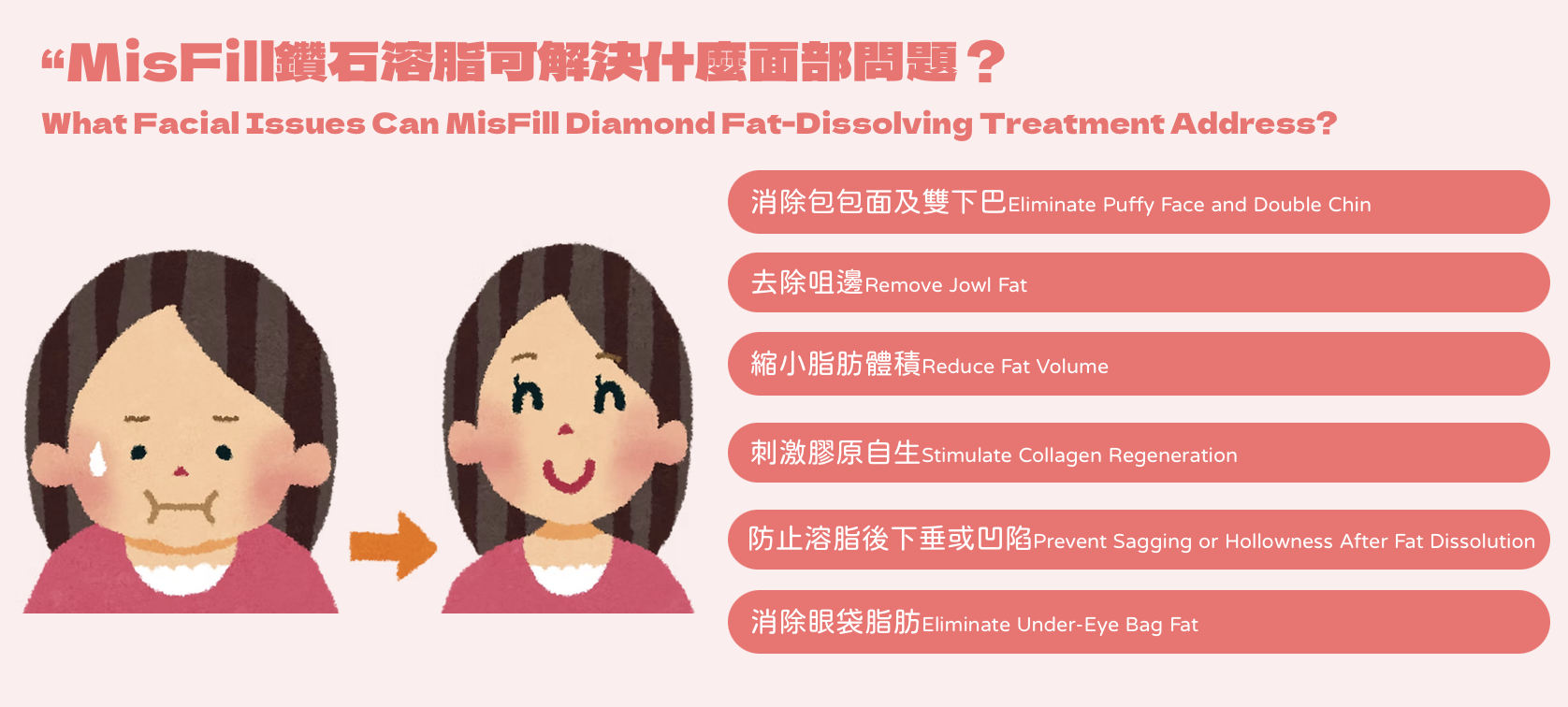 韓國MisFill 鑽石溶脂針 溶脂同時膠原自生 醫美診所 钻石溶脂针 溶脂同时胶原自生 医美诊所