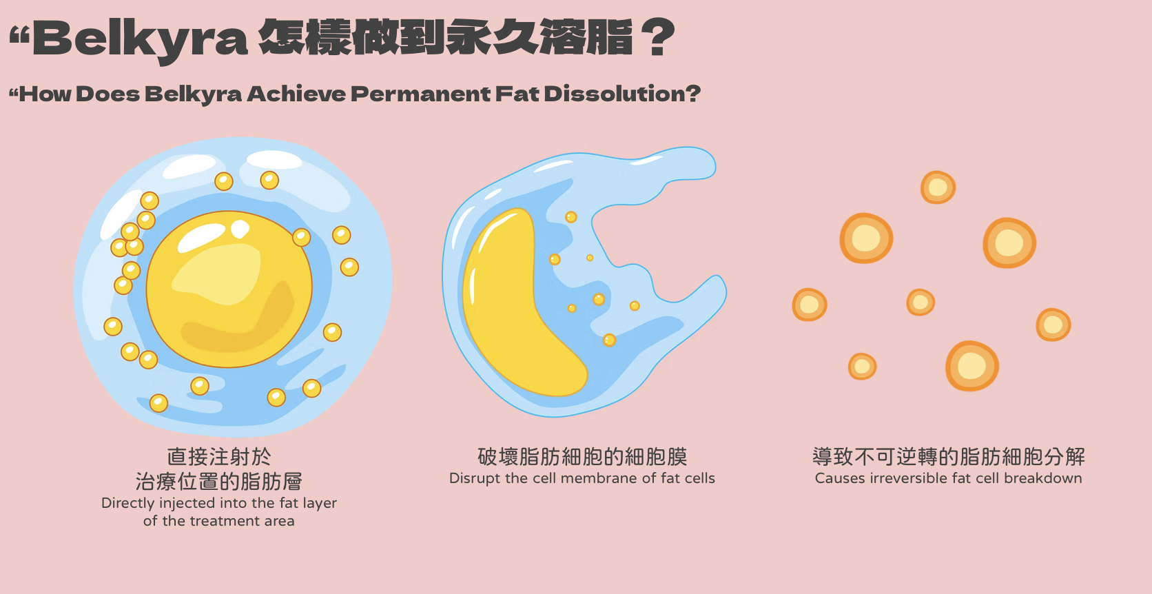 永久雙下巴溶脂Belkyra 醫美診所 永久双下巴溶脂 医美诊所