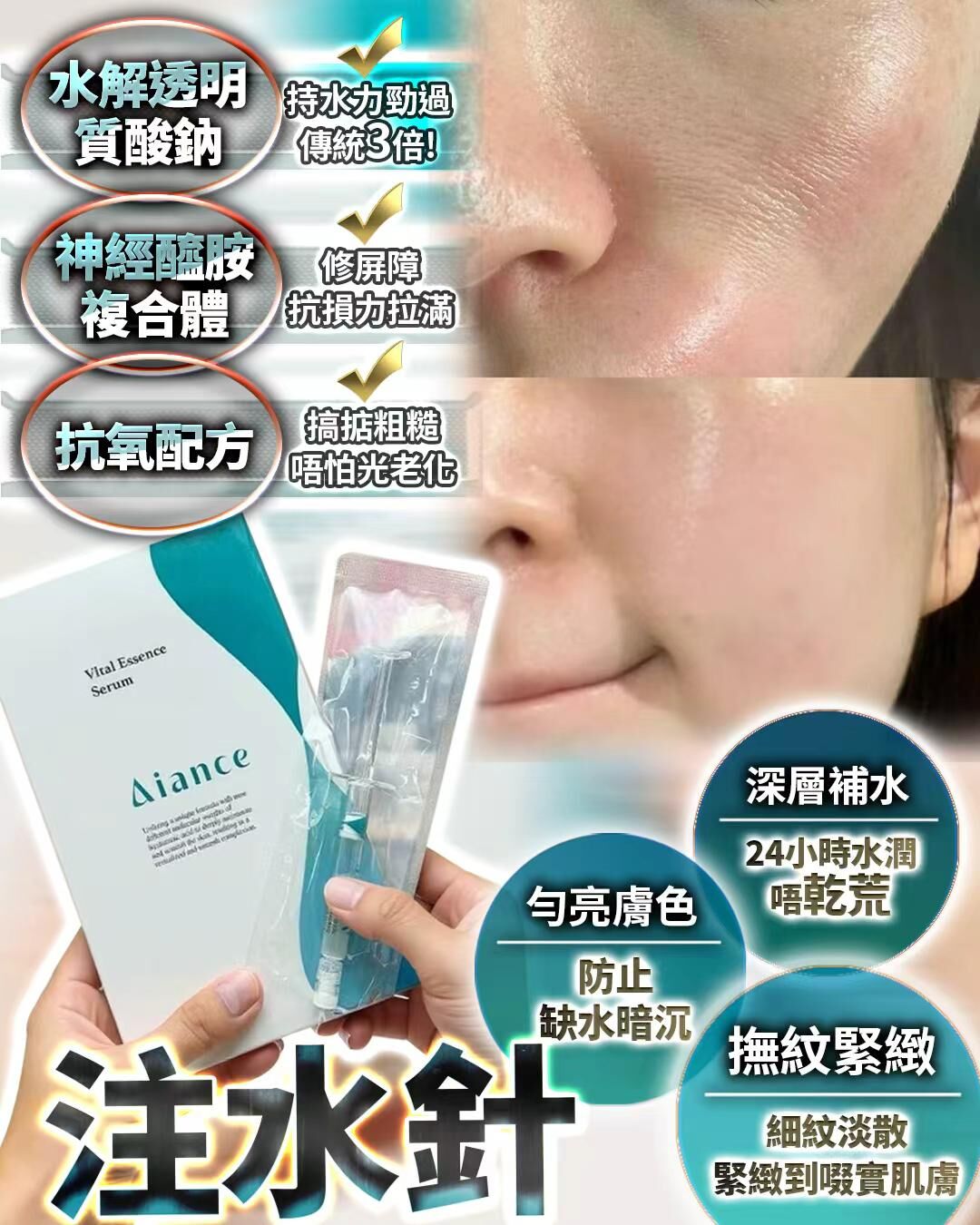 Aiance 注水針 3mlx10  Z873（2-3星期寄出）