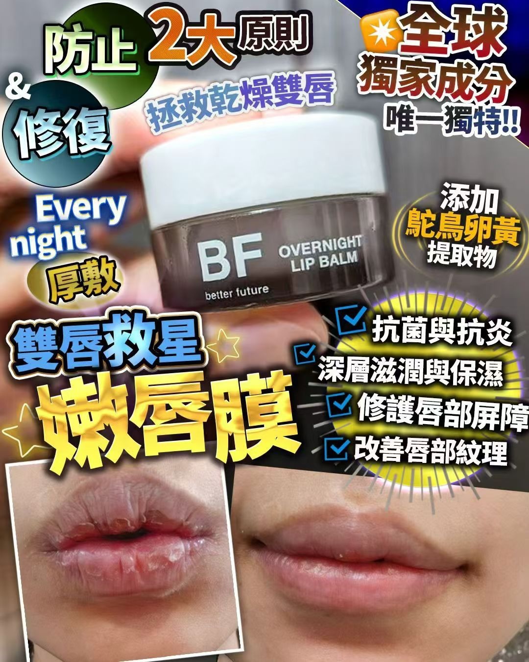 嫩唇膜 Z565（2-3星期寄出)