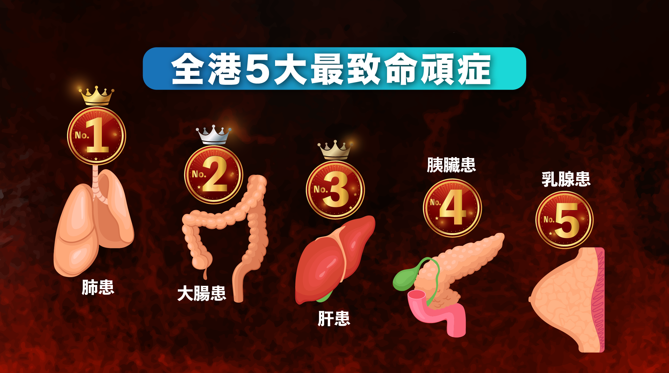 每年全港約有15,000人死於頑症，佔全港總死亡人數約四分之一；最致命的頑症依次為肺患、大腸患、肝患、胰臟患和乳腺患。隨著頑症研究的深入，越來越多的天然產品被發現其對抗頑症的潛力，其中褐藻糖膠與桑黃成為了當前備受關注的兩種天然物質。這篇文章將探討褐藻糖膠及桑黃抗頑的有效性，讓大家認識這些天然成分的潛力。