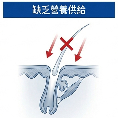 缺乏營養供給，容易脫落