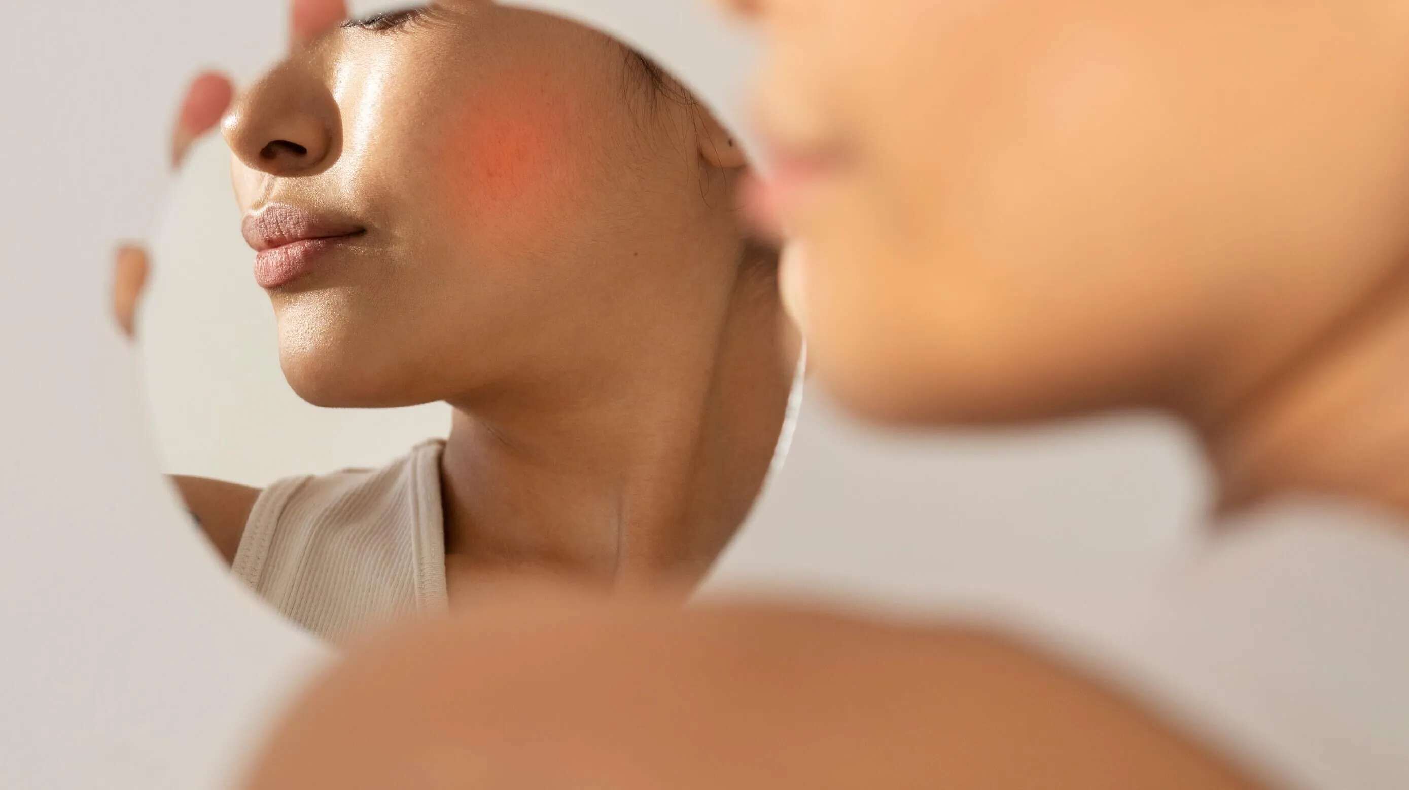 臉泛紅原因＿角質層屏障受損，受到刺激引發臉部微血管過度擴張