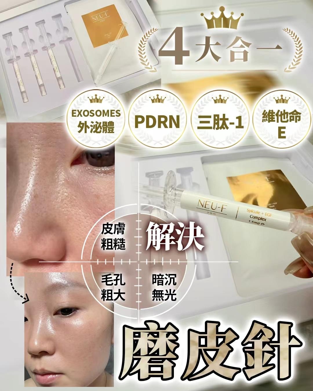 NEU-F Pro Spicule + EGF  磨皮針