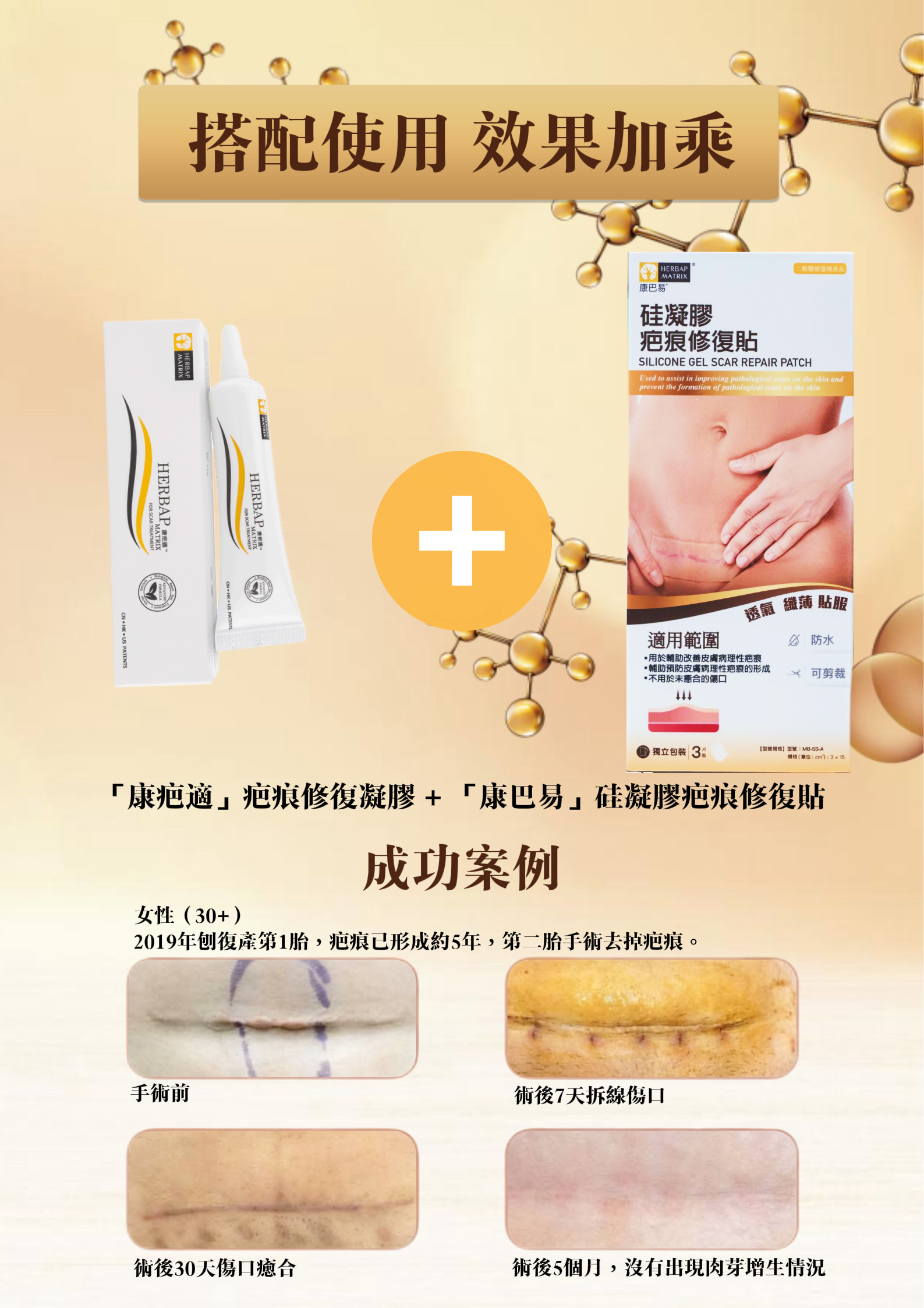 康疤適疤痕修復凝膠 + 康巴易矽凝膠疤痕修復貼