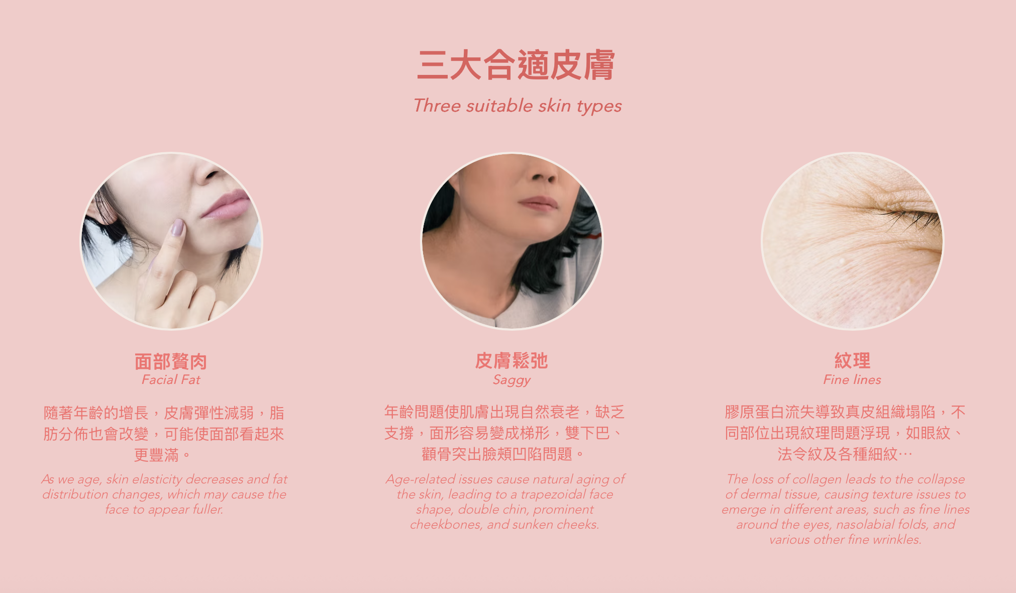 Ultherapy 超聲刀 超声刀