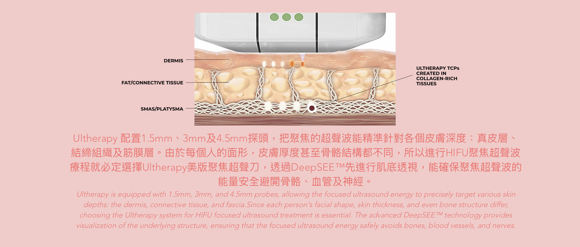 Ultherapy 超聲刀 超声刀