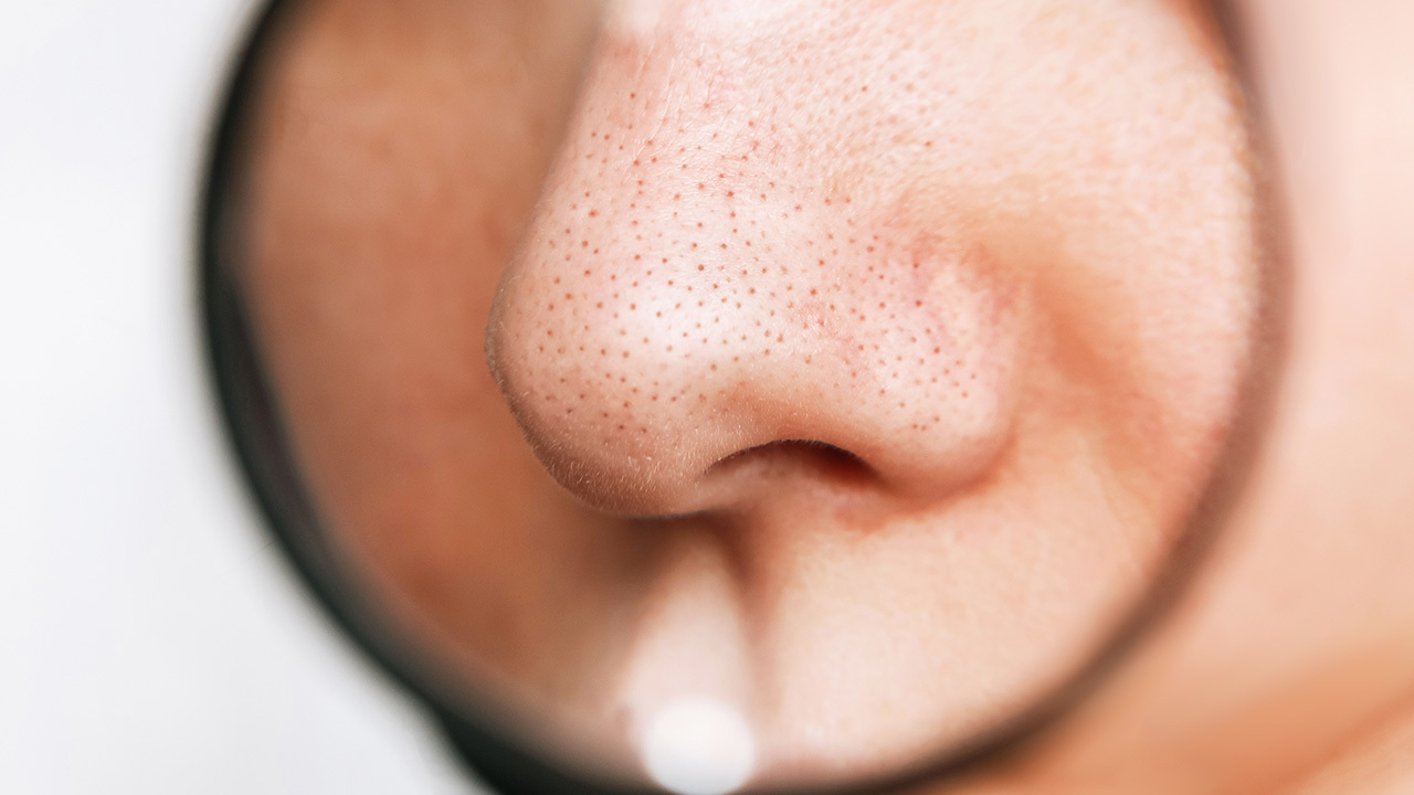 維生素B3（菸鹼醯胺）