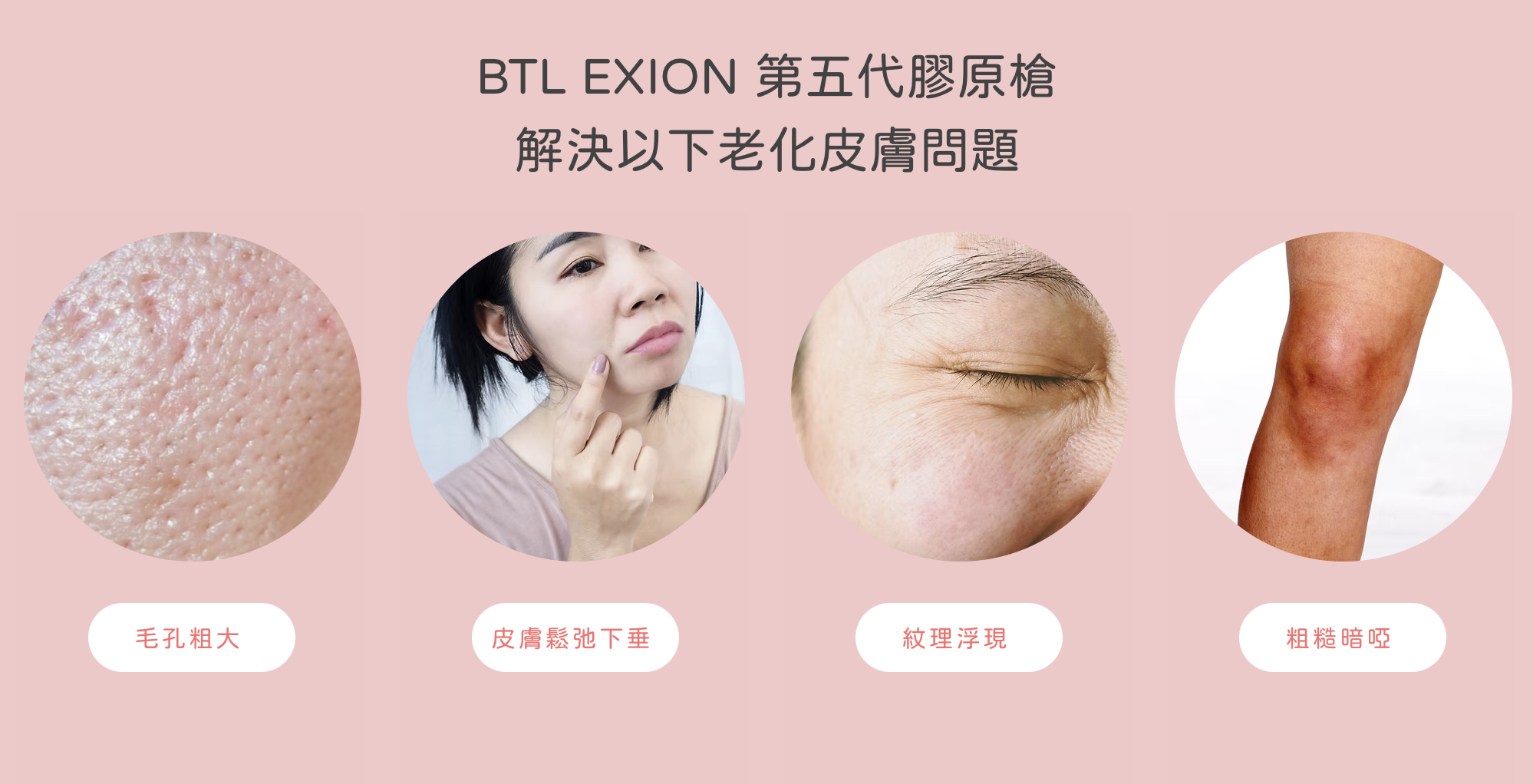 BTL EXION 膠原槍 眼袋槍 醫美 Facial 面部護理 胶原枪 眼袋枪 医美 面部护理