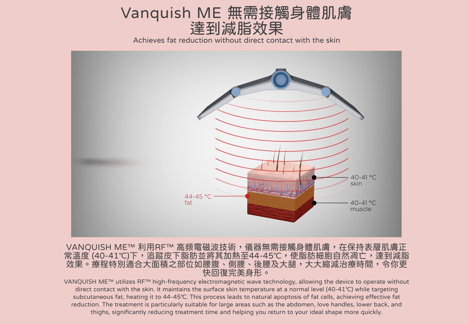 Vanquish, 隔空溶脂, 瘦身,減肥