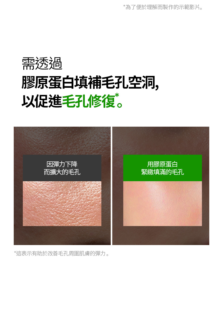 超低分子女神注射