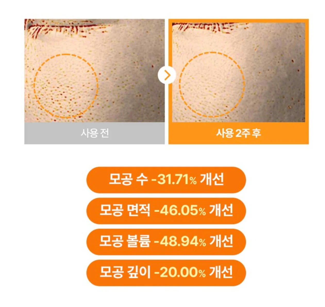 TORRIDEN 純維C美白保濕透肌精華 [30ml]