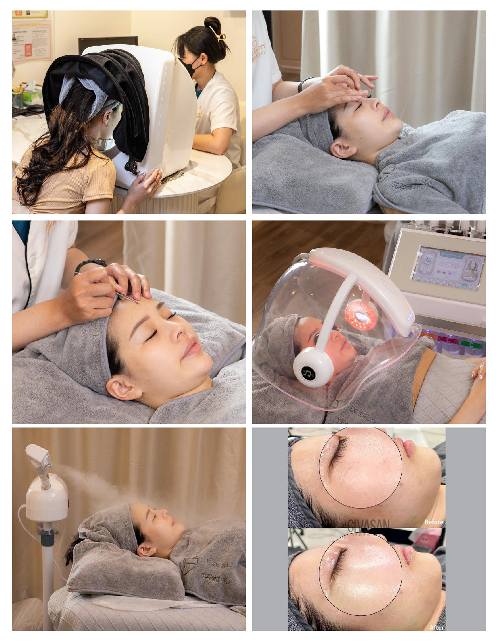 悅熙美容中心 體驗照片