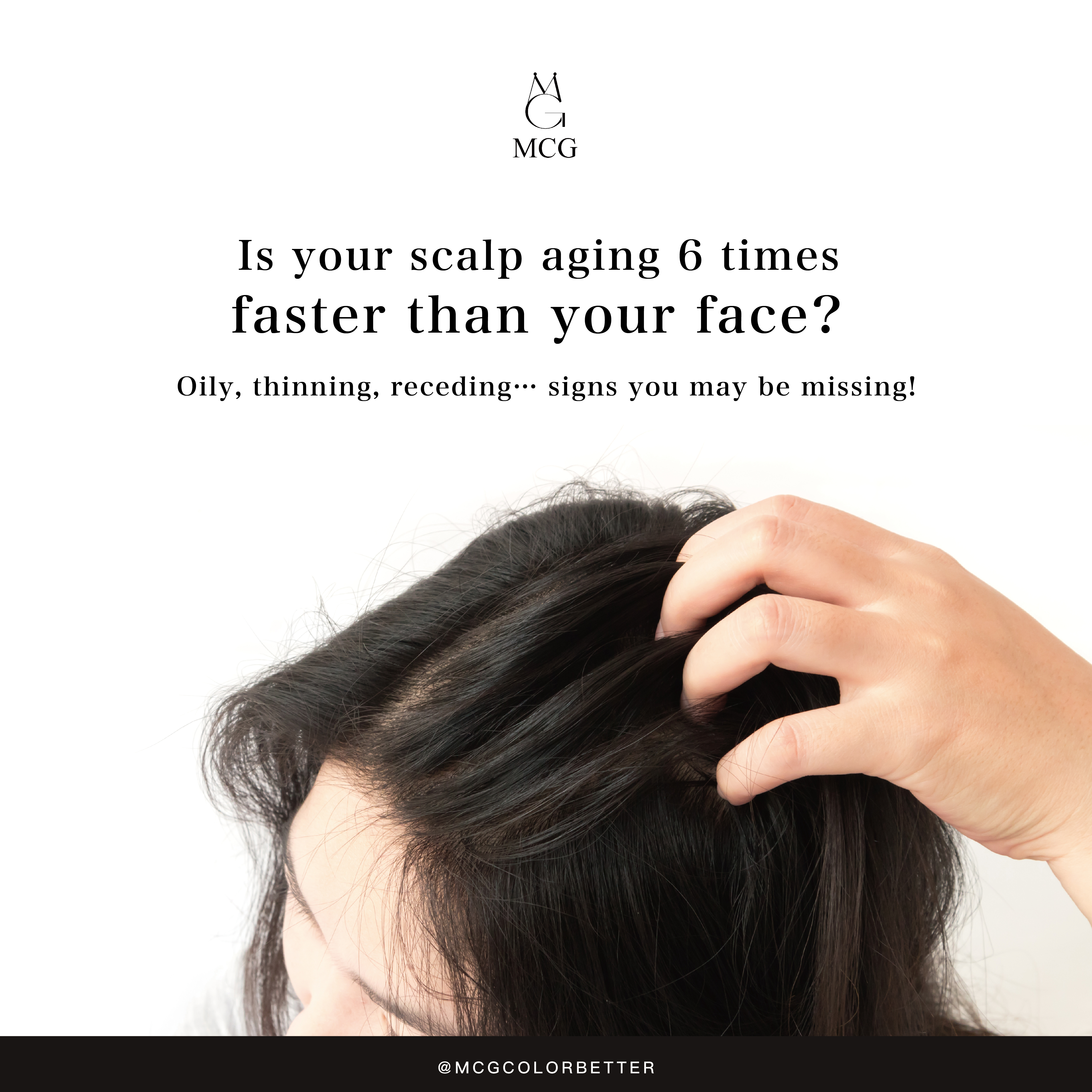 Is your scalp aging 6 times faster than your face? Oily, thinning, receding… signs you may be missing!