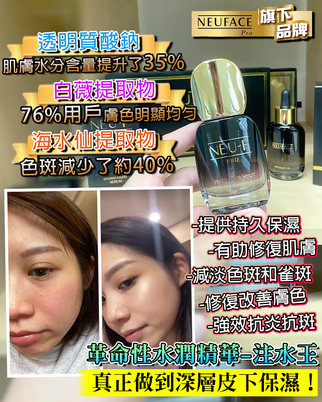 Neu-F Pro Hydro Light Serum 注水王
