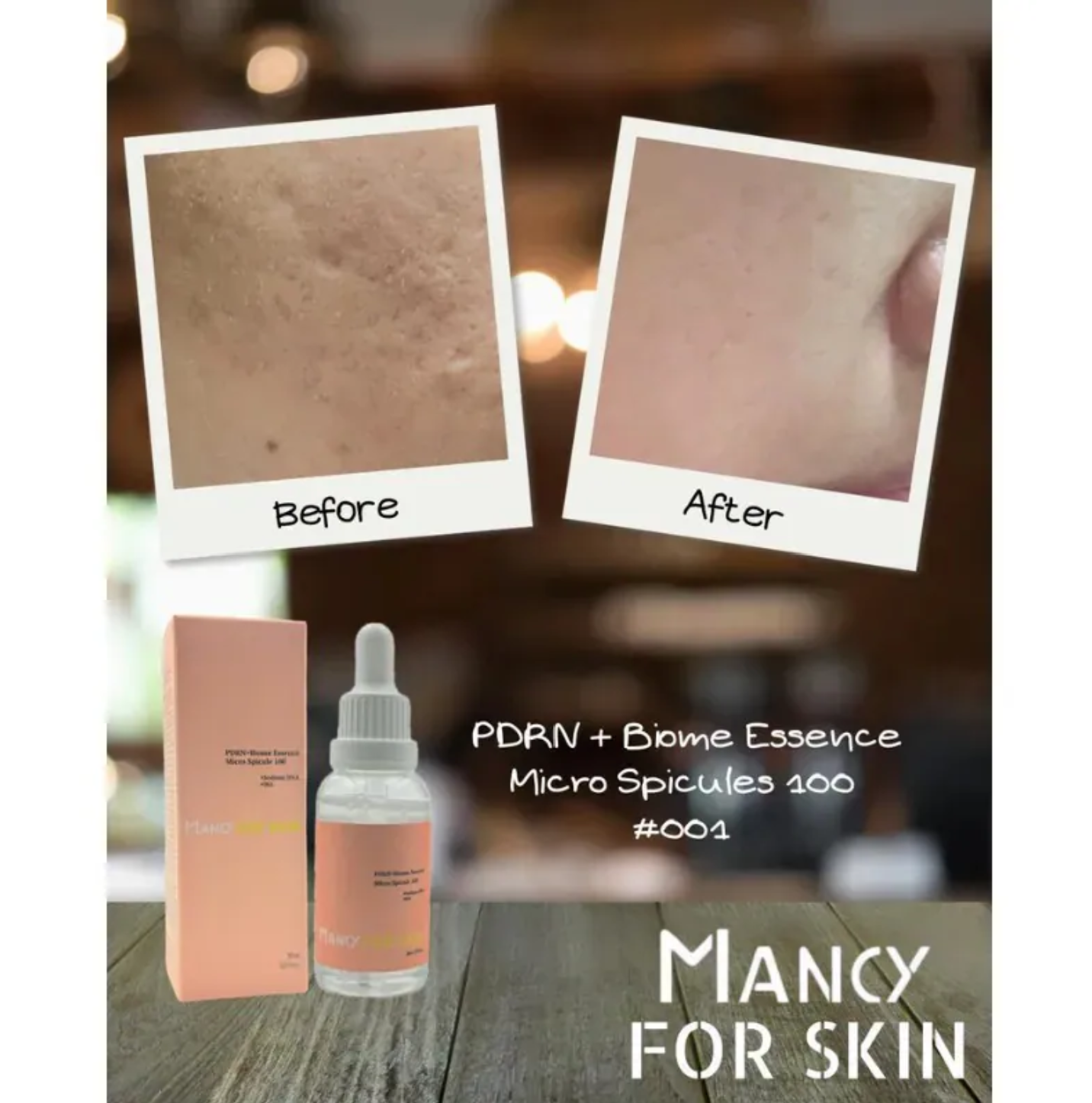 【Mancy For Skin】 精華護膚系列|精華素、精華面膜|強靭肌膚底層至真皮層|深層補水|減少暗沉和抗氧化|舒緩鎖定與抗炎|修護皮膚屏障【10/19 截單，預計 :10月尾至11月中發貨】