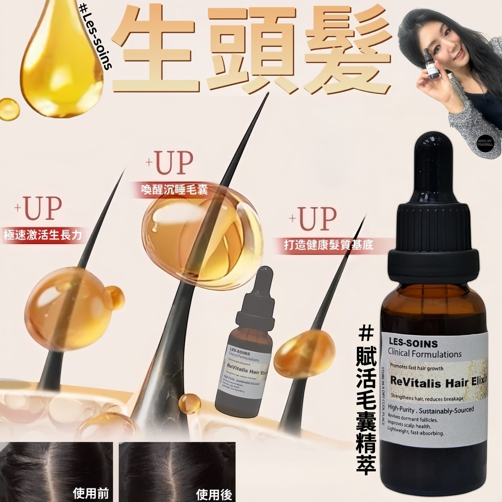（生頭髮） Les-soins賦活毛囊精萃20ml Z938 ReVitalis Hair Elixir✨根源賦活育髮精/賦活毛囊精萃✨混合2款買3 送1（任選4件）再送一個頭髮轆✨