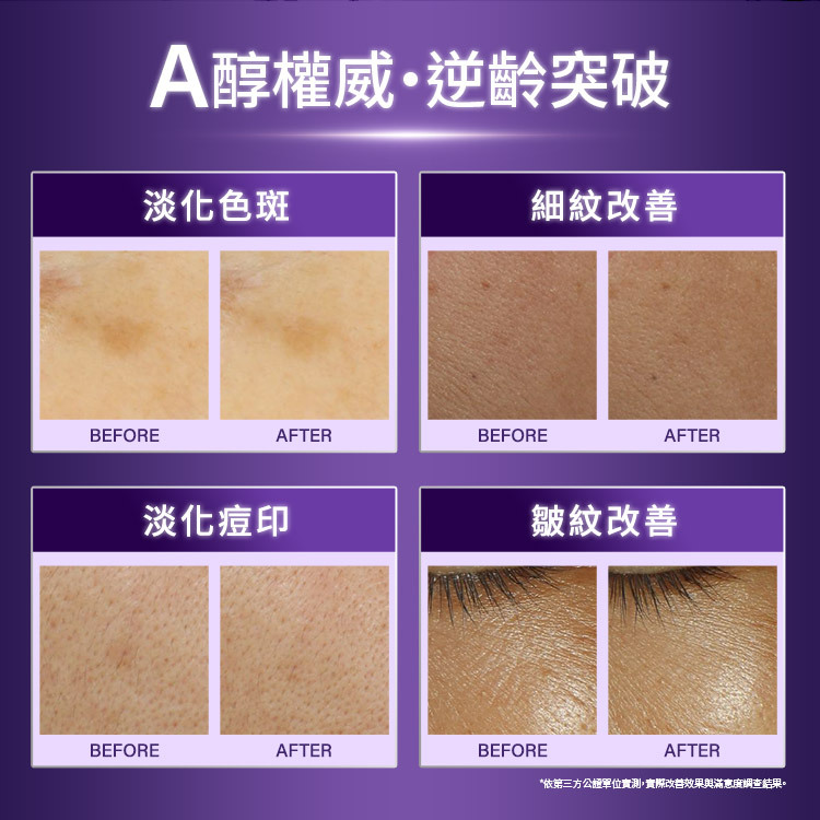 A醇權威・逆齡突破 Before 與 After 實測對比。展示內容包含:淡化色斑對比、細紋改善對比(臉頰與眼周)、以及淡化痘印對比。依第三方公正單位實測結果。