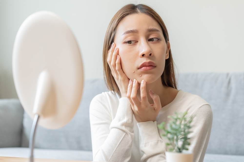 膿包型痘痘如何處理？可透過使用抗生素藥物、痘痘針和小型手術切除