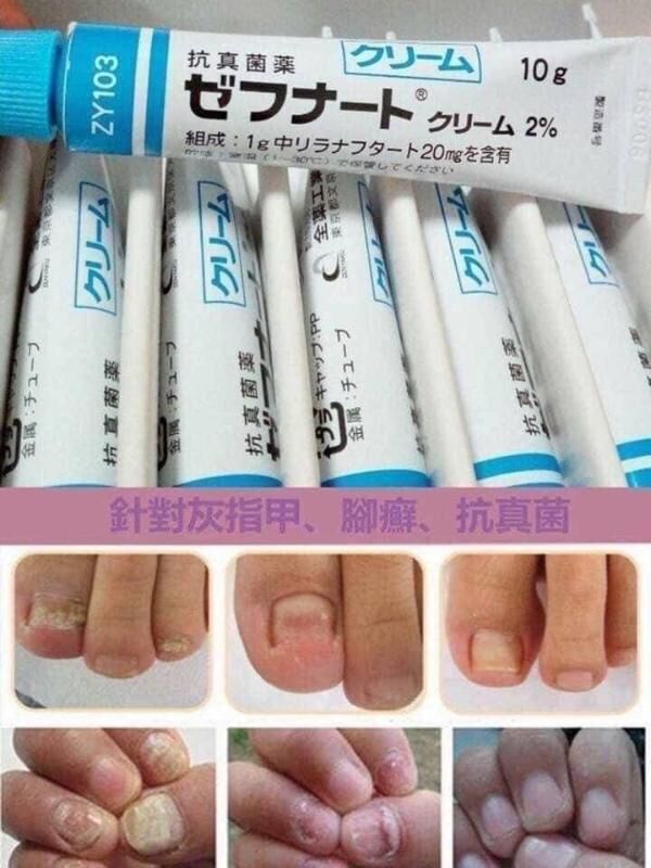 鳥居製藥｜ZEFNART 灰甲抗真菌藥膏