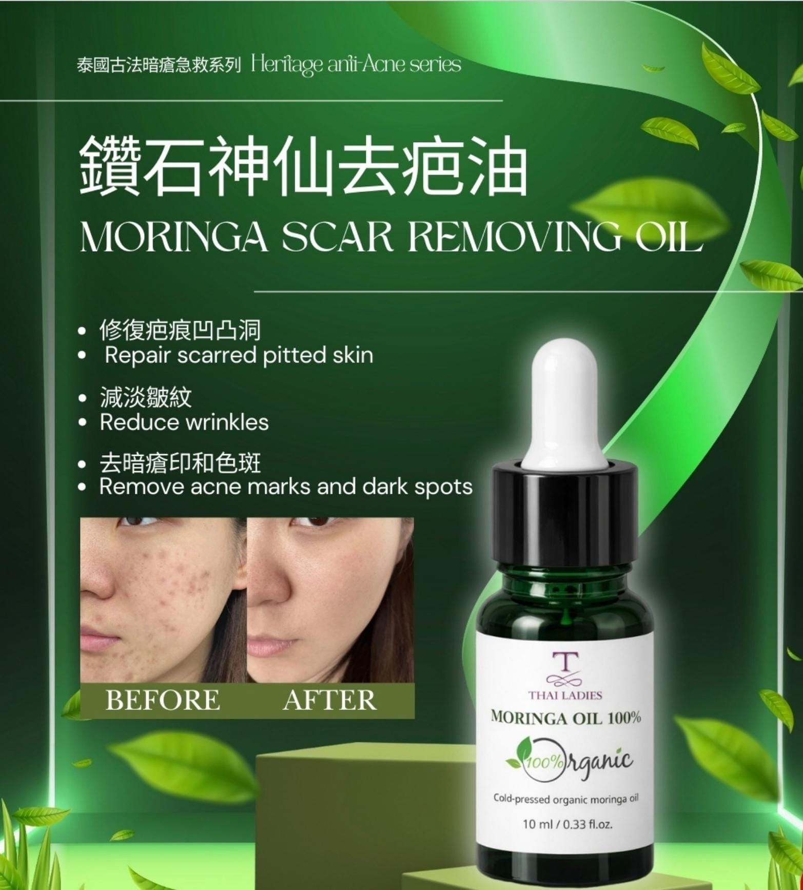 鑽石神仙去疤油 10ml