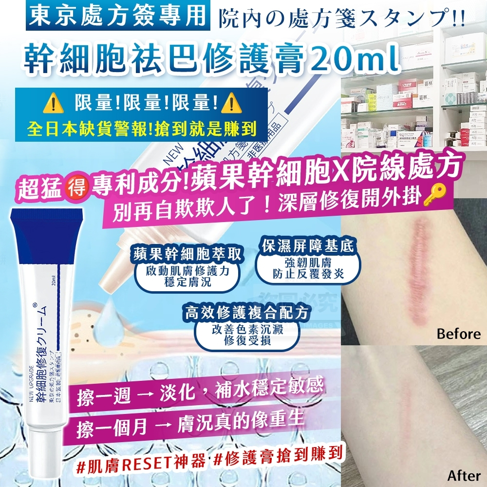 WSBB10532 東京處方簽專用｜幹細 胞祛巴修護膏 20ml （4月上旬 ）
