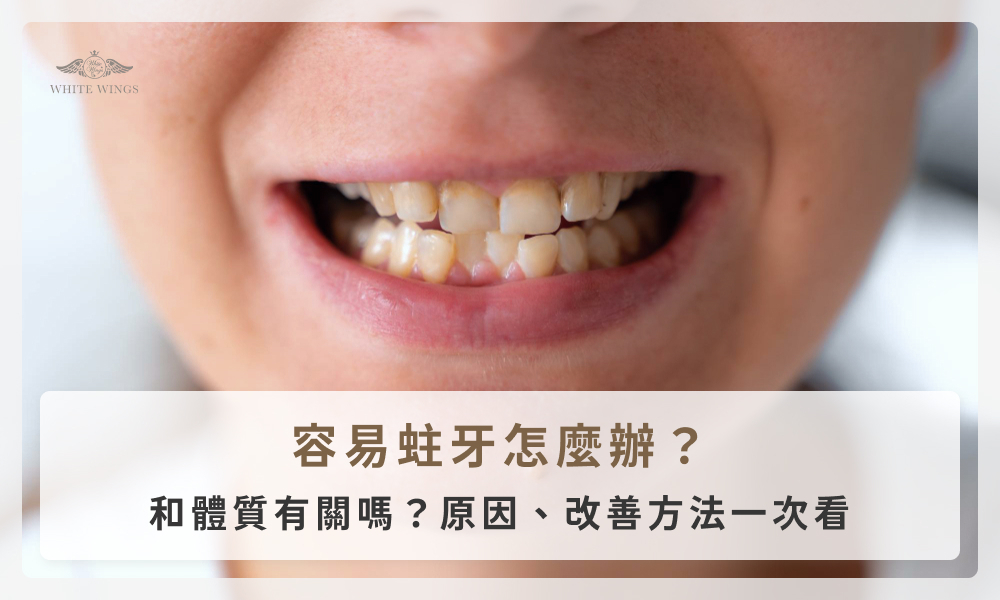 容易蛀牙怎麼辦？和體質有關嗎？原因、改善方法一次看