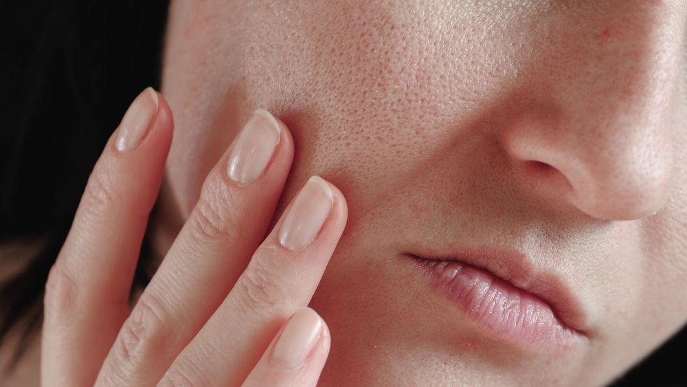 改善毛孔粗大治療