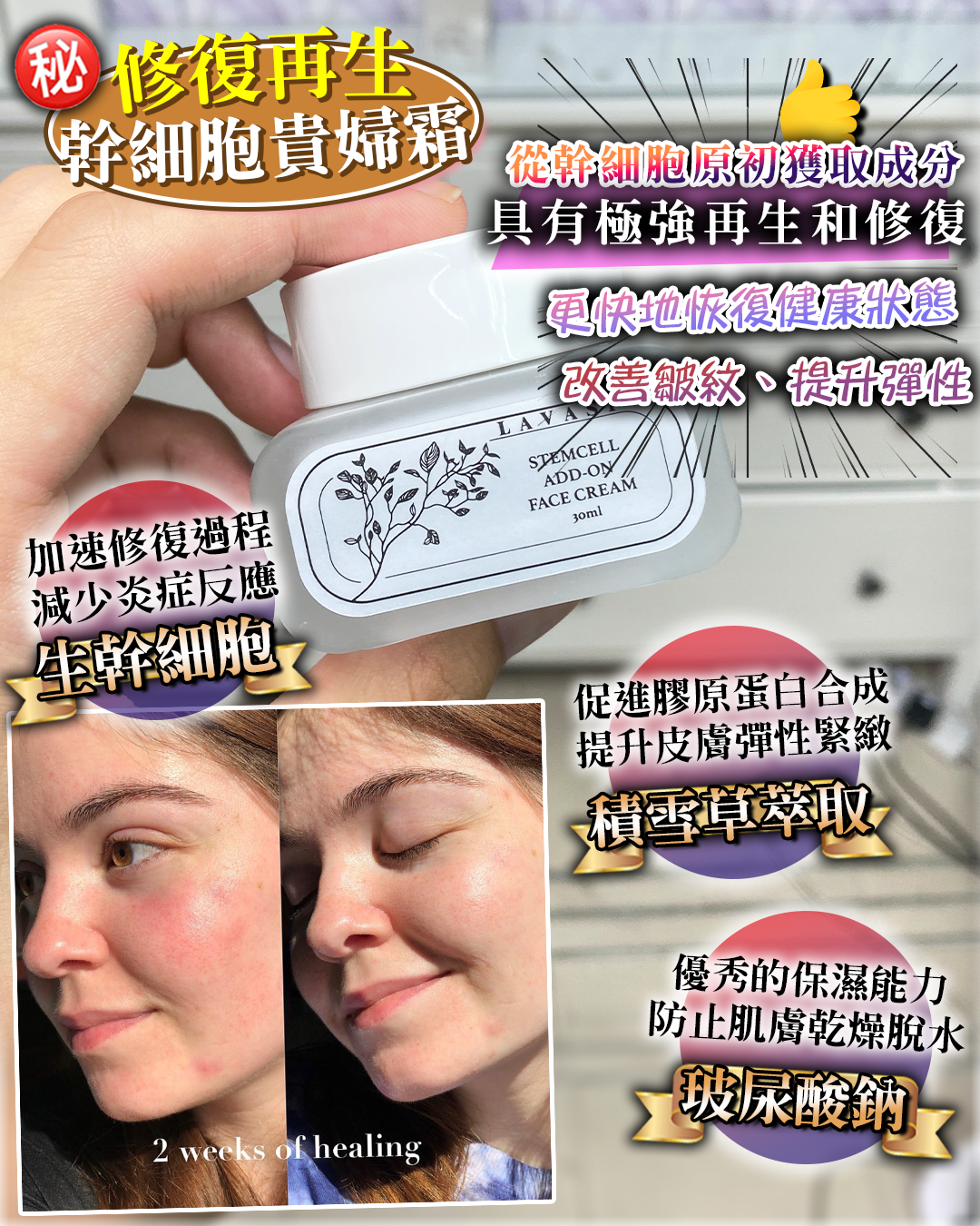 2026 「馬」上靚新春福袋優惠_ Lavasi StemCell Add-On Face Cream 送 注水王 5m+Recovery Oil 3ml+Omni Mask 1片
