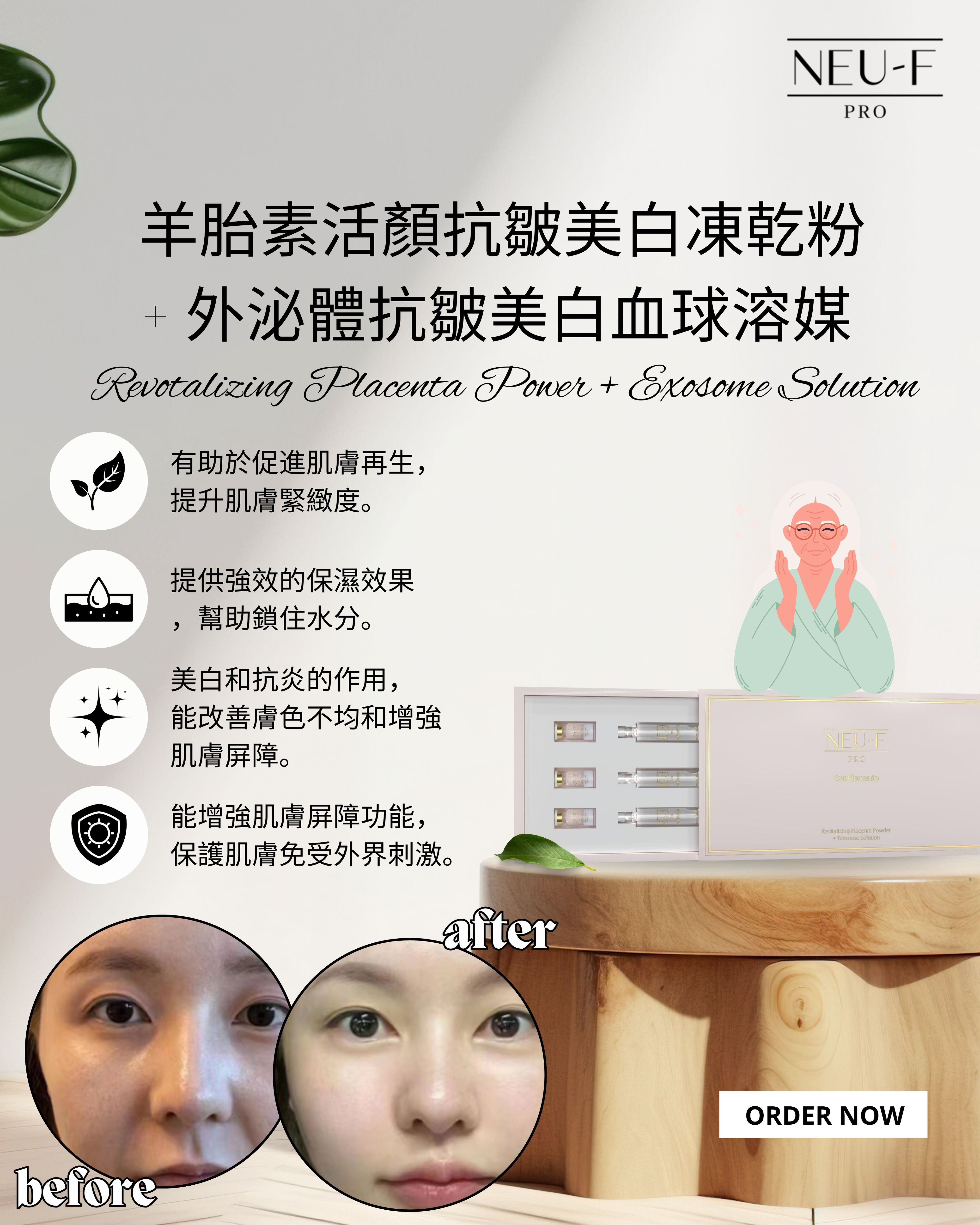 2026 「馬」上靚新春福袋優惠_  Neu-F Pro 羊胎素外泌體凍齡美白套裝 + PDRN+Protein Thread蛋白線雕 送 注水王 5ml x2 + Recoveryoil 3ml x2 + Omni Mask 4pcs + 酵素洗面素 20 ml x1