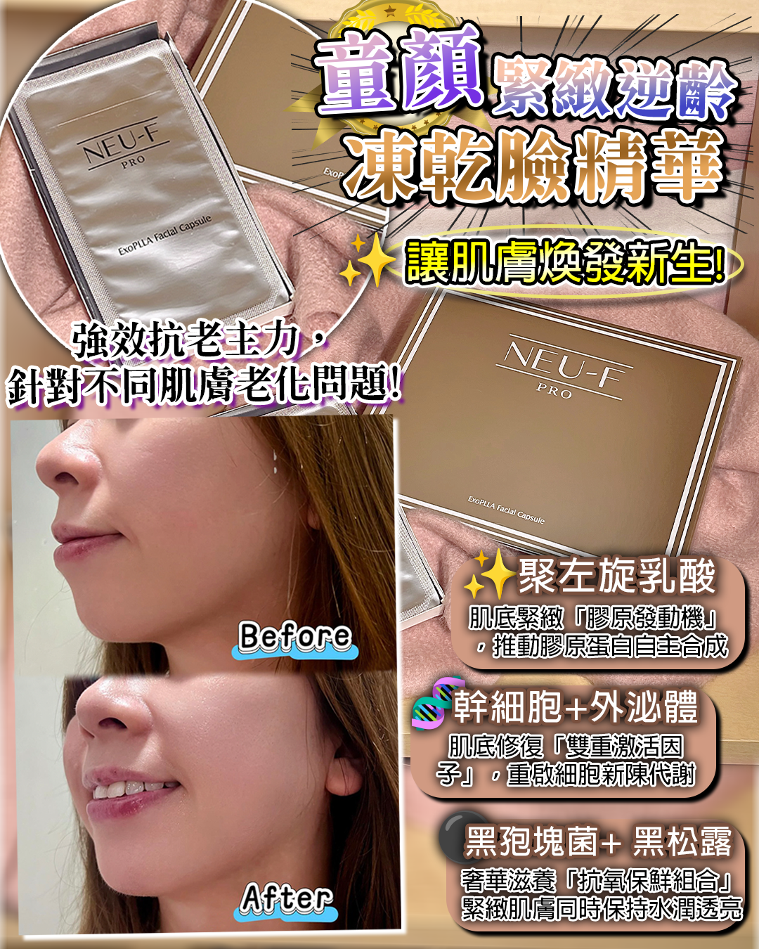 2026 「馬」上靚新春福袋優惠_ Neu-F Pro Exo PLLA Facial Capsule + Exo PLLA Eye Capsule 送 注水王 5ml x2 + Recoveryoil 3ml x2 + Omni Mask 4pcs + 酵素洗面素 20 ml x1