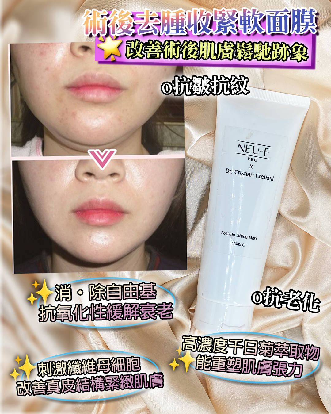 Neu-F Pro 3D Eye Mask + Post-Op Lifting Mask 送 注水王 5ml x2 + Recoveryoil 3ml x2 + Omni Mask 4pcs + Random Serum 20 ml x1