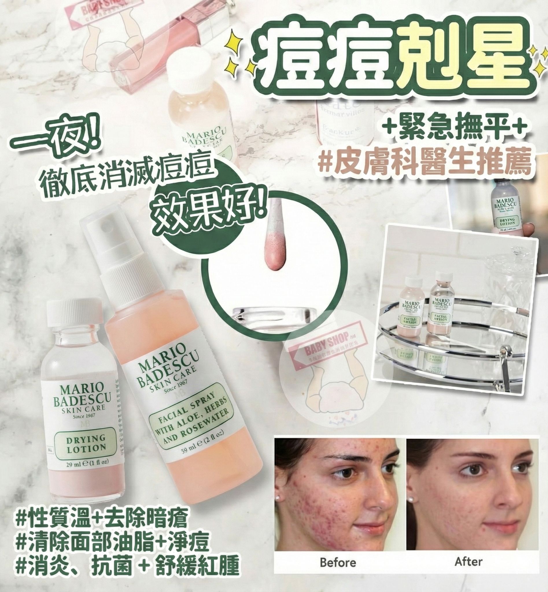 【預購】MARIO BADESCU  K0214050 淨痘精華 (買一送一)