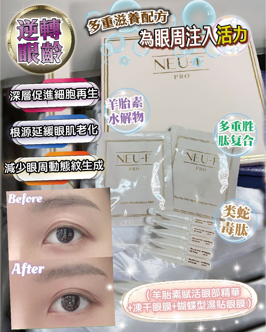 2026 「馬」上靚新春福袋優惠_  Neu-F Pro Placenta NAD + Revitalizing Eye Treatment 羊胎素再生活顔抗皺眼貼 + Revitalizing Eye Serum 送 Revitalizing Toner 1盒 + Neu-F pro neck mask 5 pcs