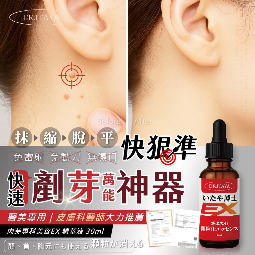 WSBB10580 DR.ITAYA® 肉芽專科美容EX 精華液 30ml(現貨)