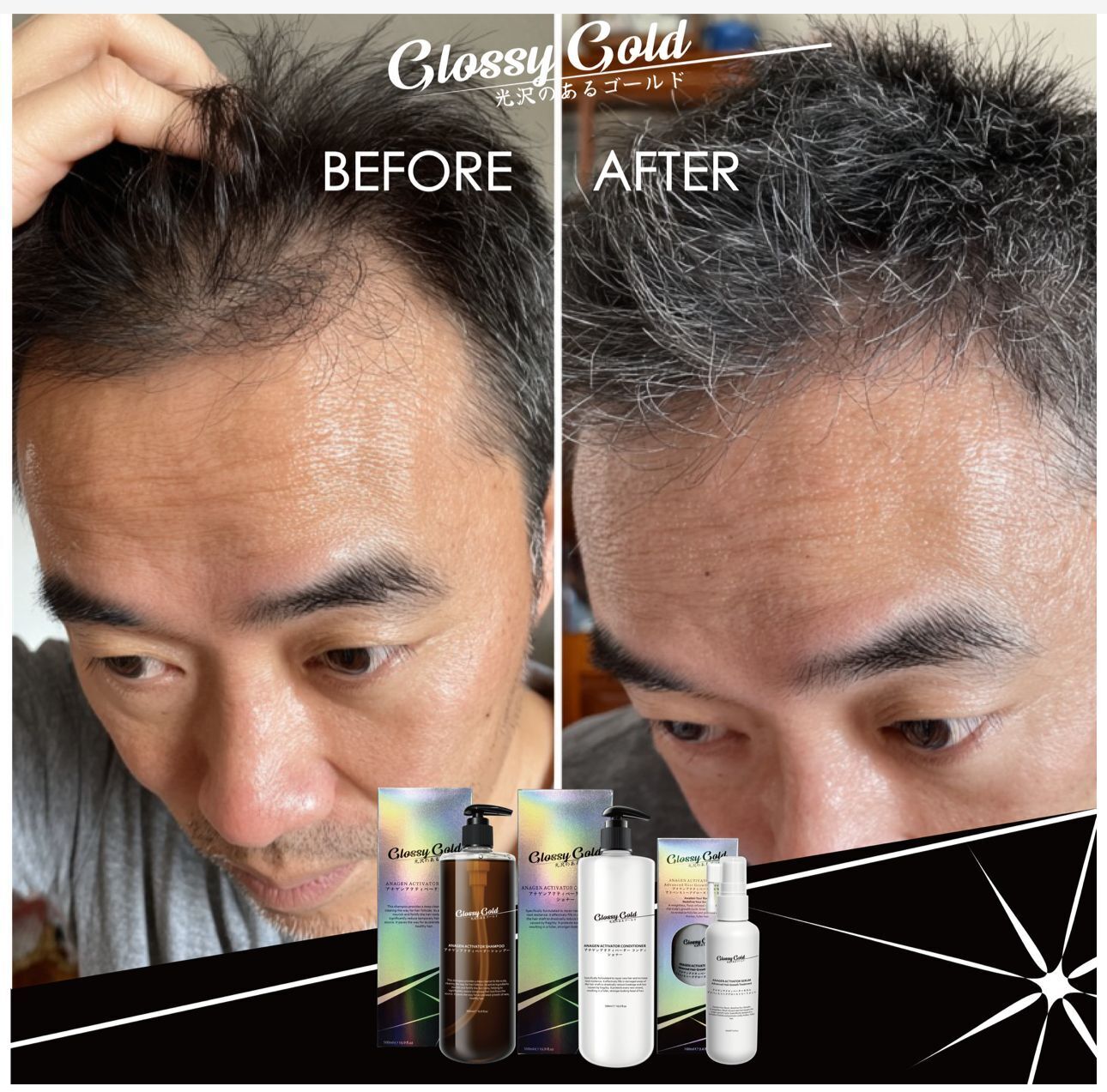 glssygold 激發生長洗髮乳~146AL