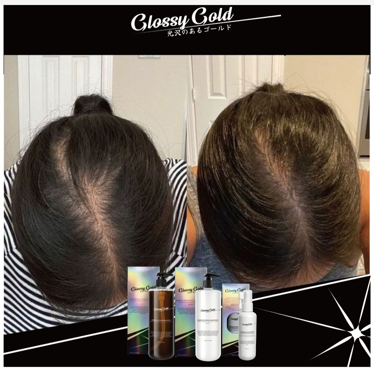 Glssy Gold 激發生長護髮素^146AM